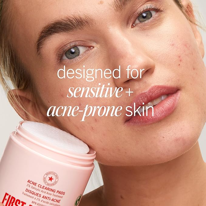 First Aid Beauty Acne Pads for Face - Maximum Strength Acne Treatment - 2% Salicylic Acid Pads Treat Without Drying, (60-ct)