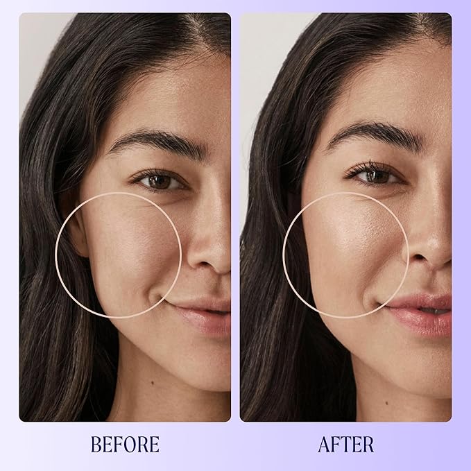 Kinship Zinc Oxide Mineral Sunscreen for Face Self Reflect SPF 32 | Vegan, Reef Safe, Non Toxic Eczema Sunscreen for Sensitive Skin | Sunblock Face Moisturizer with SPF (1.75 oz)