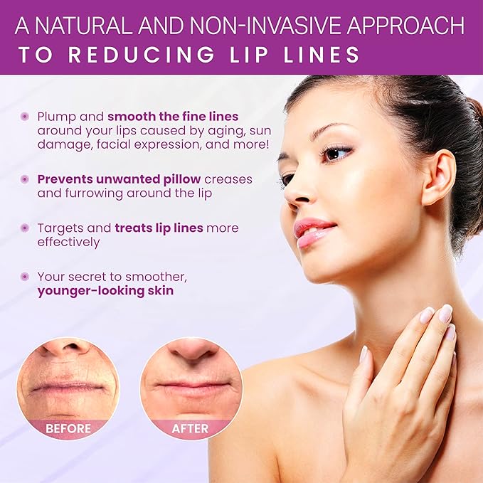 Furlesse Lip-Sticks Wrinkle Patches, Overnight Anti-Wrinkle Patches for Smile Lines, Fine Lines, and Expression Lines, Non-invasive Lip Patches, Anti-aging Skincare, 120 Patches, 30-Day Use