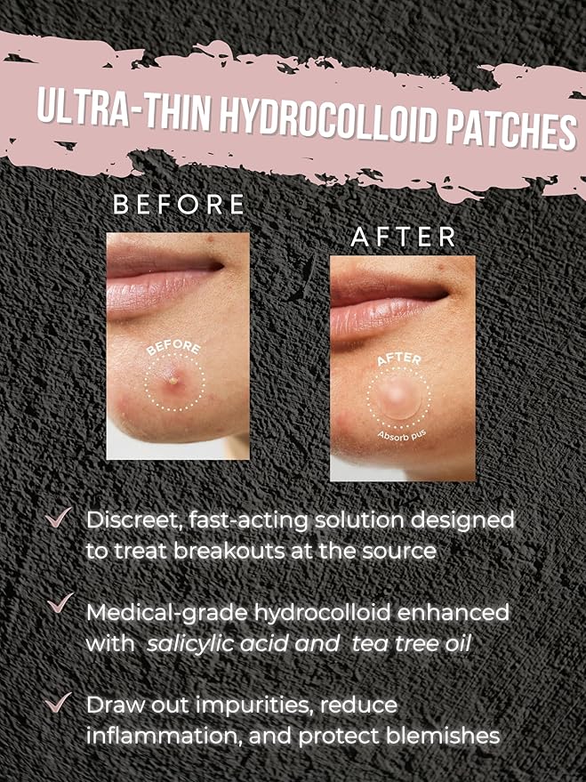 Acne Patch Ultra Thin Invisible Spot Cover- Fast Acting Hydrocolloid Pimple Patch with Salicylic Acid, Centella Asiatica & Tea Tree Oil- 72 Ct. Effective Treatment Absorbs Zits and Blemishes