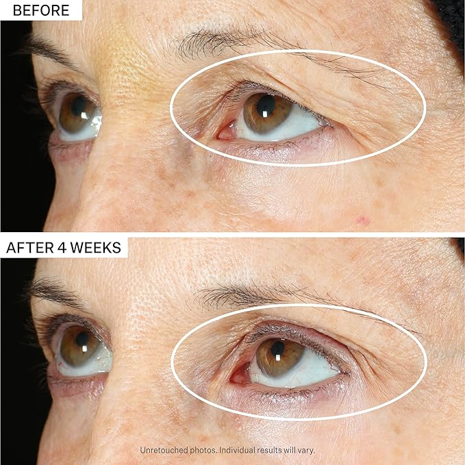 StriVectin Tighten & Lift Peptight 360 Degree Eye Serum with Tightening & Brightening Peptides for Wrinkles, Under Eye Bags and Puffiness, 1 fl. Oz