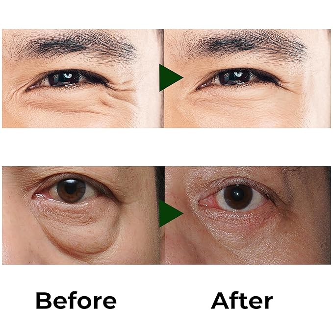 Abera Eye Roller Serum with Mint Essence, Vitamin C and Peptides - Energizing Serum for Dark Circles and Puffiness, Fine Lines Serum, 0.34 fl oz