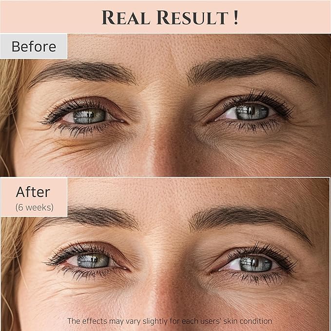 Beauty of Joseon Revive Eye Serum with Retinal Niacinamide Peptide for Face Under Eyes Wrinkles Dark Circles Moisturizer Cream Korean Skincare 30ml, 1 fl.oz * 2pack