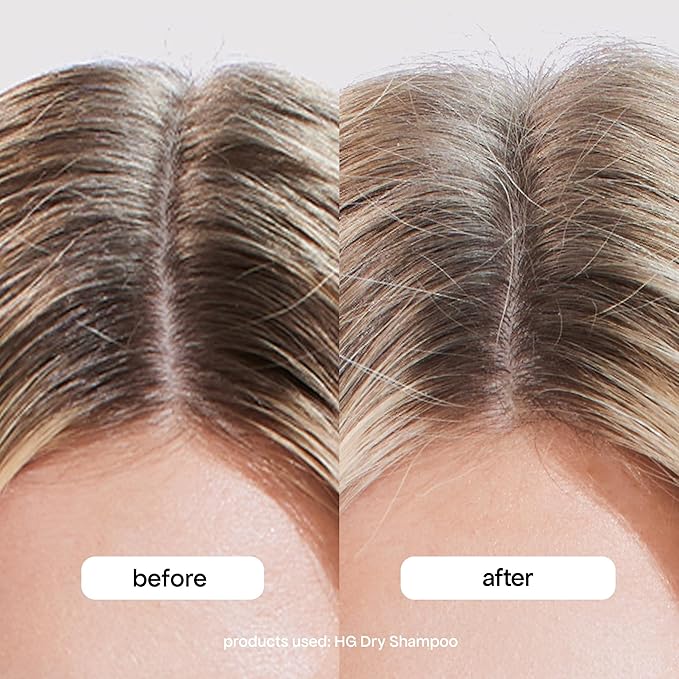 BONDIBOOST HG Dry Shampoo For Women & Men [3.95 oz] - Clinically Tested to Cleanse + Volumizes Hair, Refreshes + Protects & Strengthens Hair - Clean Formula with Rosemary - All Hair Types