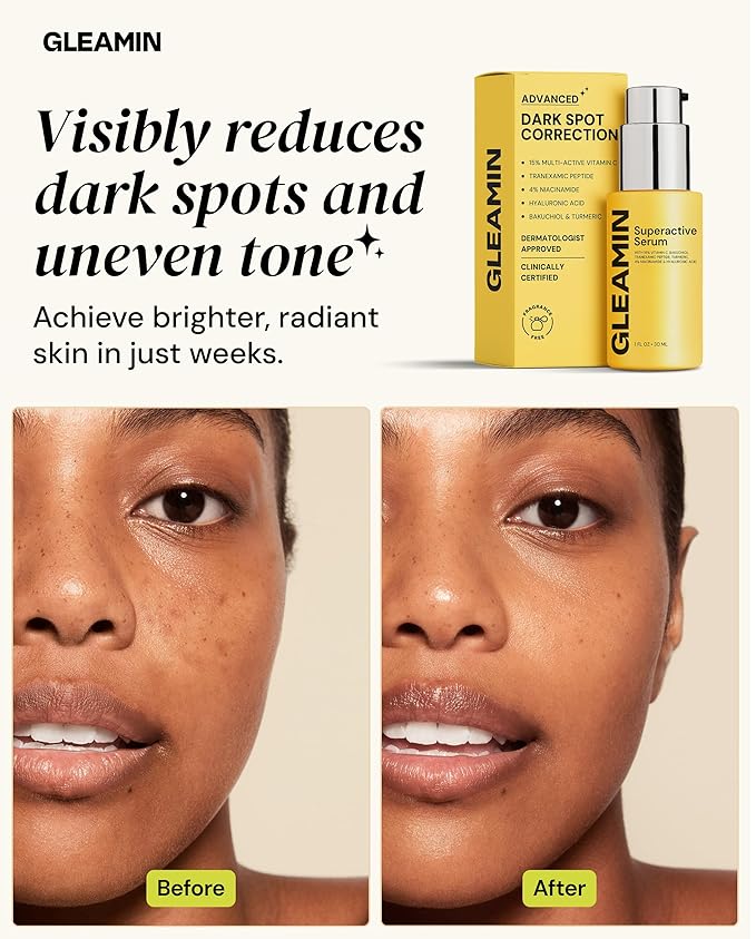 Gleamin Superactive Vitamin C Serum for Face with 15% Vitamin C, Niacinamide, Bakuchiol & Hyaluronic Acid – Skin Brightening Facial Serum for Women & Men – Dark Spot Remover & Radiant Glow – 1 fl oz