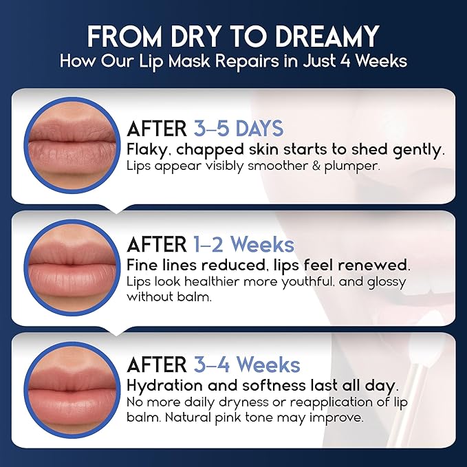 Lip Mask Overnight with Hyaluronic Acid & Collagen, Lip Sleeping Mask for Dry Cracked Lips, Moisturizing, Hydrating, Exfoliating Night Treatment for Lip Care (Berry)