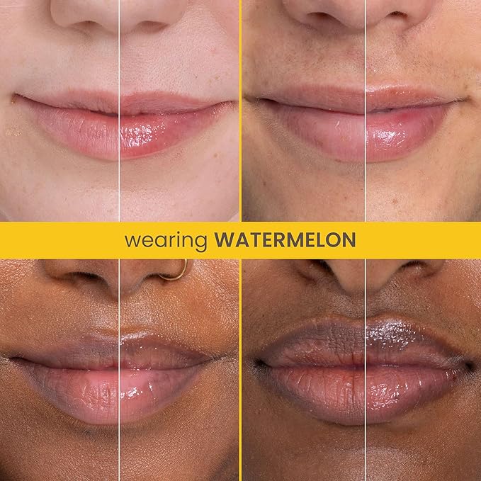 Burt's Bees Rescue Lip Relief, Watermelon, Hydrating Lip Balm for Dry Cracked Lips, with Responsbily Sourced Beeswax and Shea Butter, 100% Natural Origin, 1 Squeezy Tube, 0.35oz